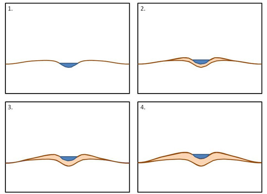 Figure 3: Formation of an alluvial ridge. Note that deposition builds up natural levees on each side of the stream as well as in the bed of the stream. 